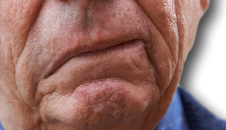 뇌졸중 초기증상 예방 운동 총정리