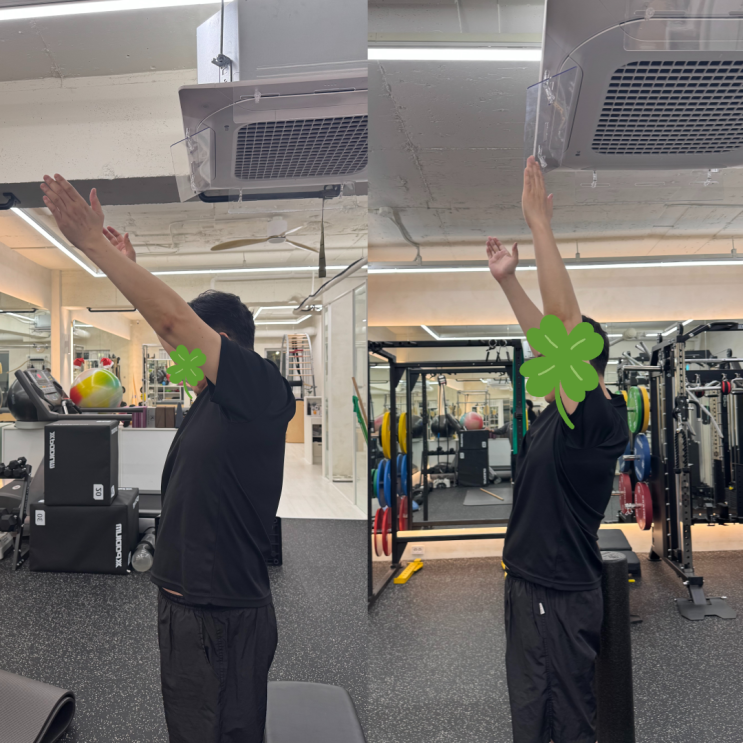 노원 수술 후 어깨가 예전 같지 않다면? 재활 PT 필라테스