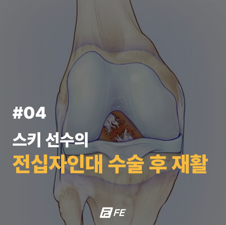 역삼피티 전십자인대 수술 후 재활 프로토콜 #4